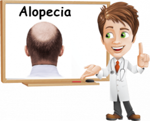 Alopecia e Calvizie sintomi rimedi e consigli