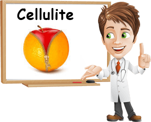 Rimedi efficaci cellulite