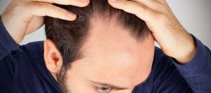[STOP TRUFFA!] Foltina Plus funziona davvero per fermare la caduta dei capelli?